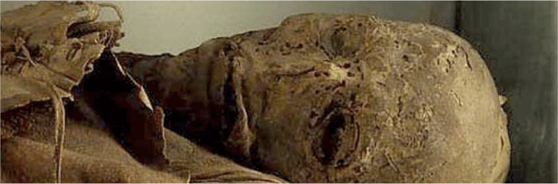 Guanche mummy in Tenerife, detail of the preserved face.